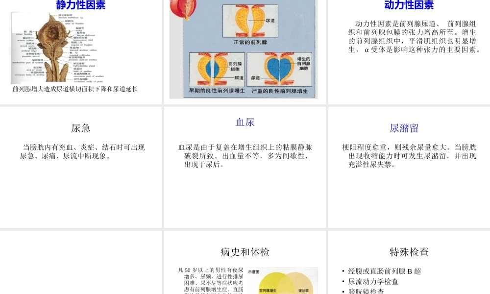 前列腺增生症.ppt