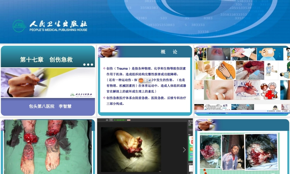 创伤急救-有各种伤.ppt