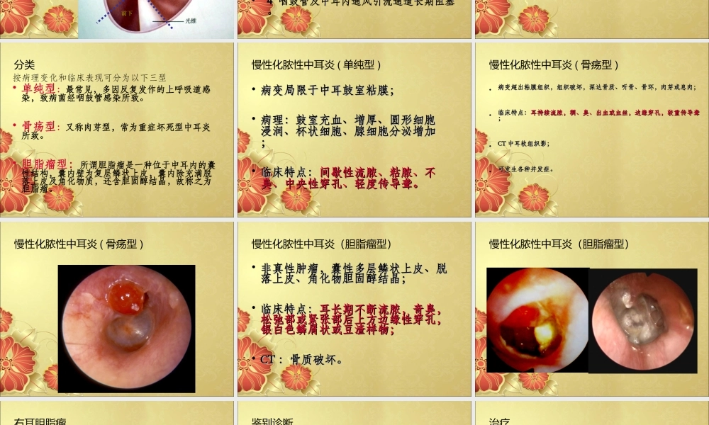 中耳炎-讲稿-2.ppt