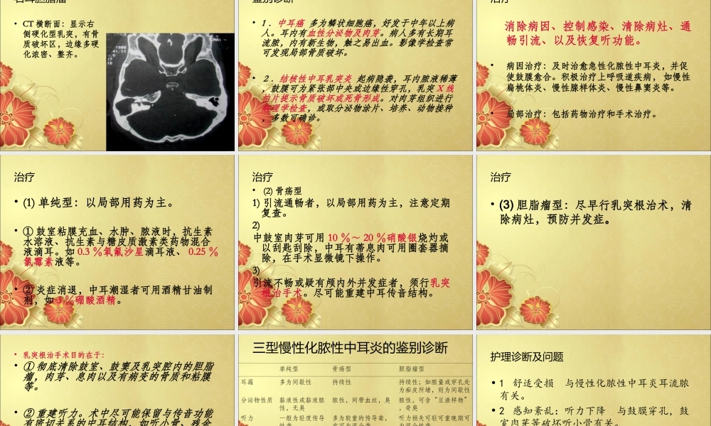 中耳炎-讲稿-2.ppt