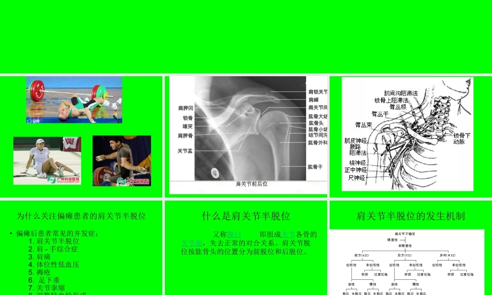 偏瘫患者肩关节半.ppt
