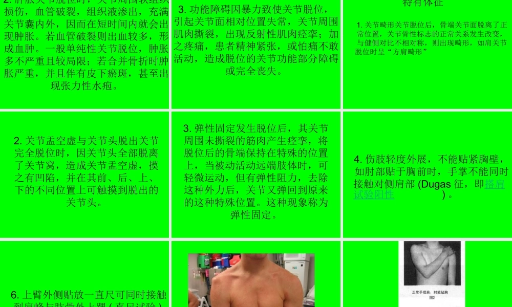 偏瘫患者肩关节半.ppt