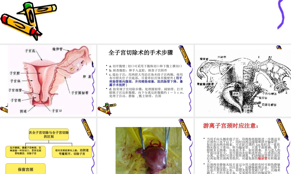 全子宫--次全子宫手.ppt