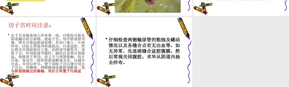 全子宫--次全子宫手.ppt