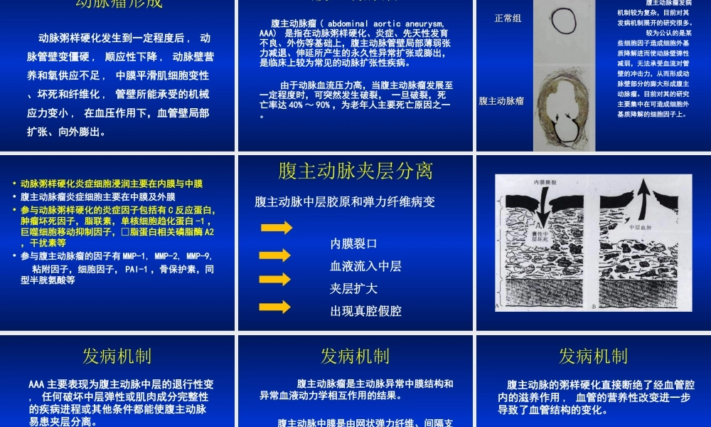 动脉粥样硬化与腹主动脉瘤.ppt