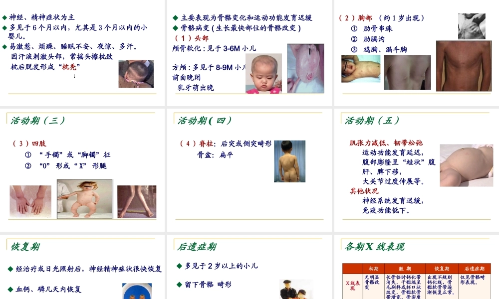 儿童维生素D缺乏.pptx