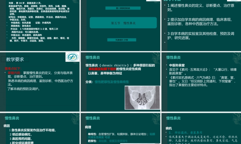 中西医结合耳鼻喉鼻炎.pptx