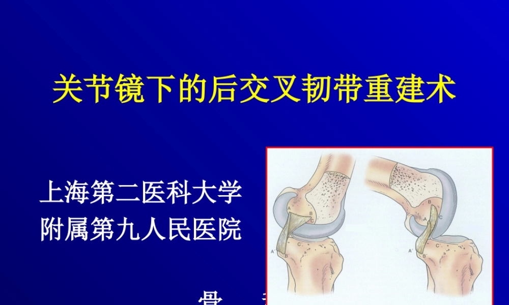 关节镜下的后交叉韧带重建术.ppt