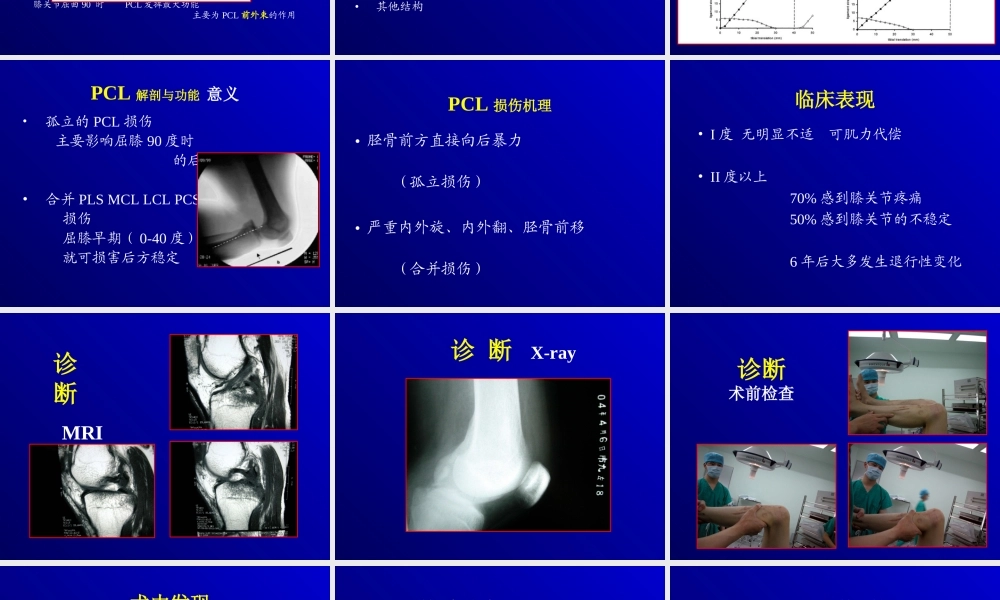 关节镜下的后交叉韧带重建术.ppt