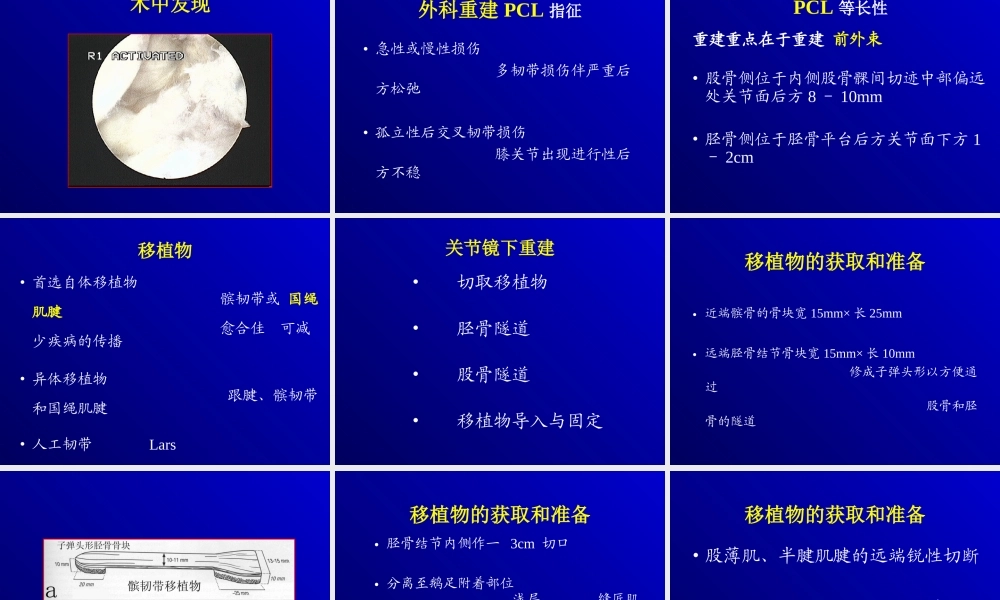 关节镜下的后交叉韧带重建术.ppt