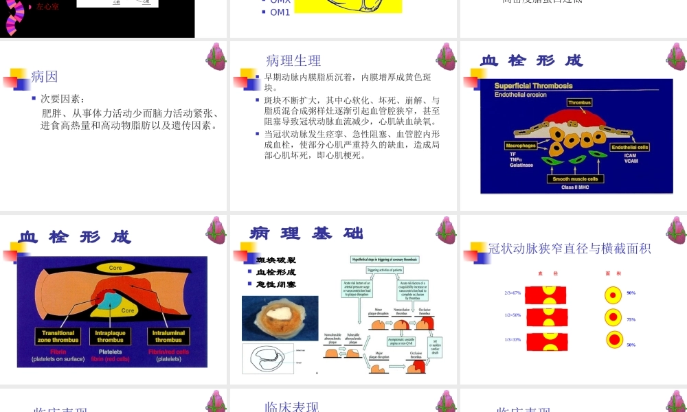 冠心病--河北--张成虎.ppt