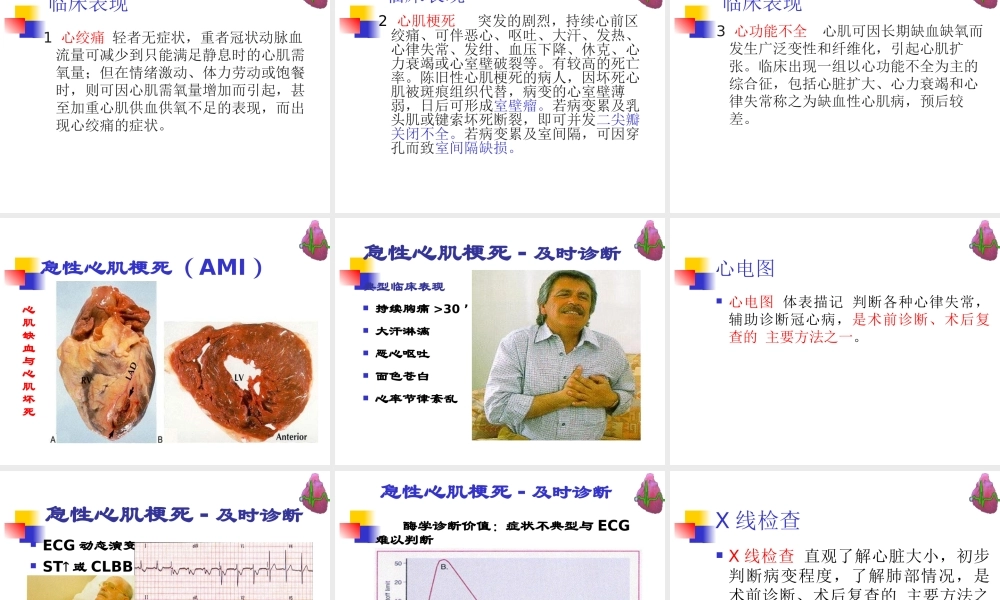 冠心病--河北--张成虎.ppt