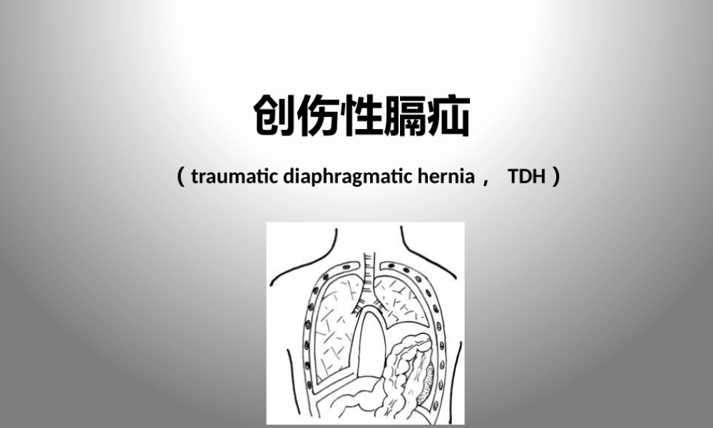 创伤性膈疝.pptx