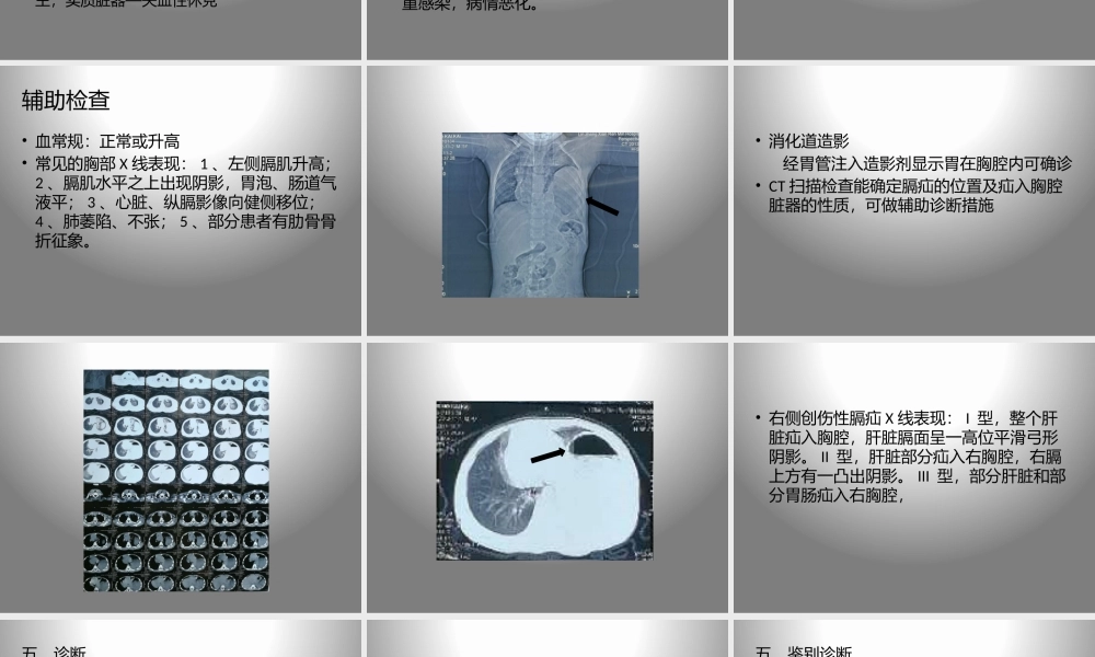 创伤性膈疝.pptx