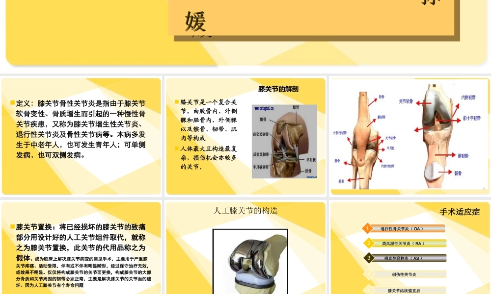 全膝关节置换术后康复.ppt