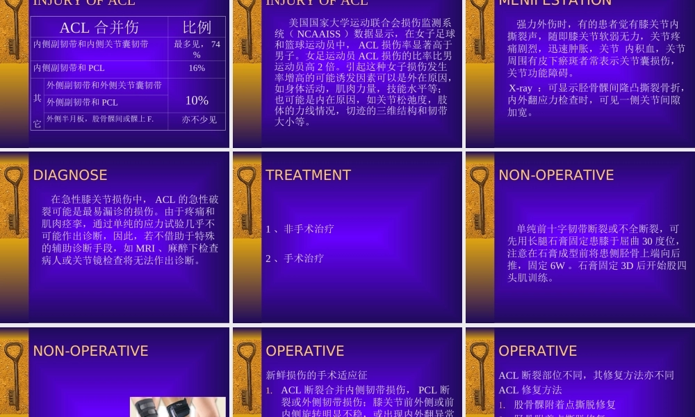 前交叉韧带损伤.ppt
