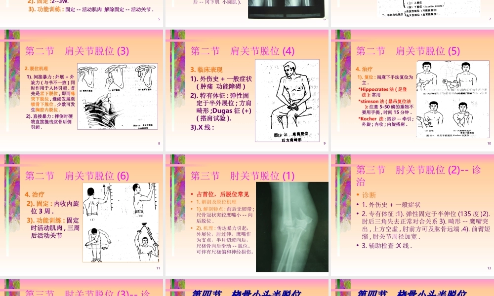 关节脱位的诊治常规.ppt