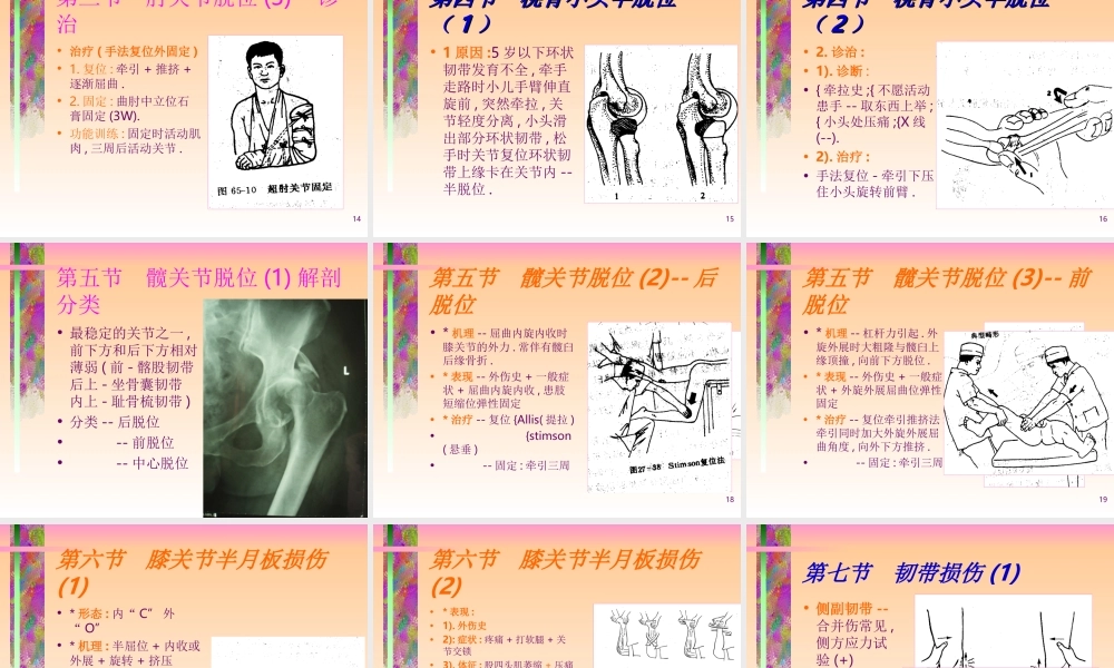 关节脱位的诊治常规.ppt