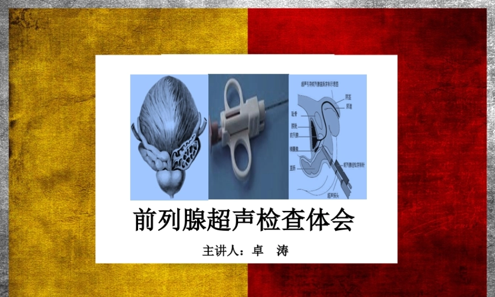 前列腺超声检查体会.ppt