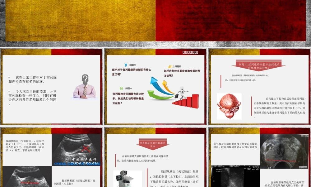前列腺超声检查体会.ppt