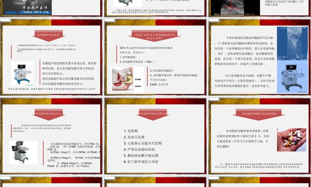 前列腺超声检查体会.ppt