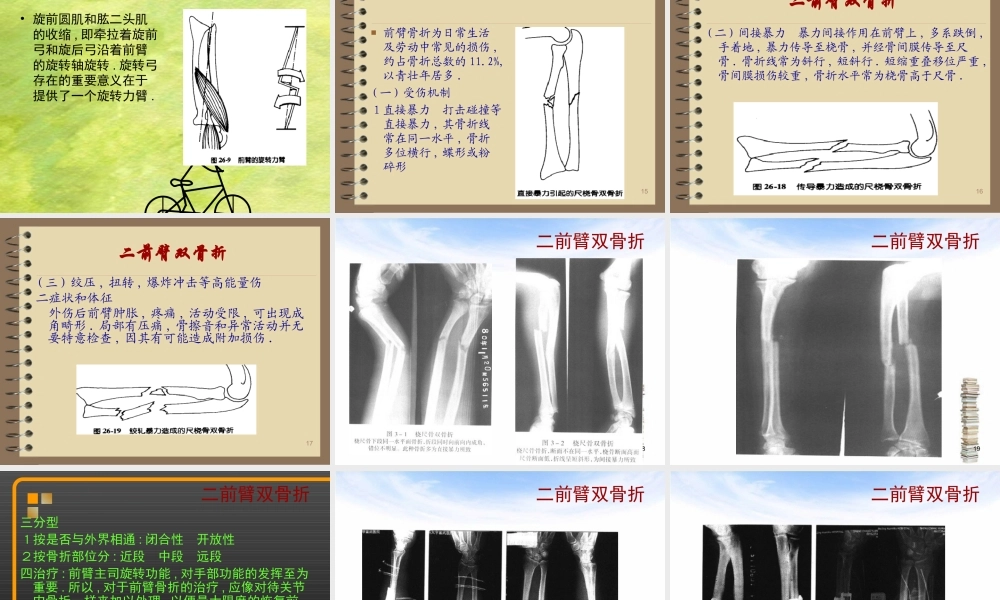 前臂骨折.ppt.ppt