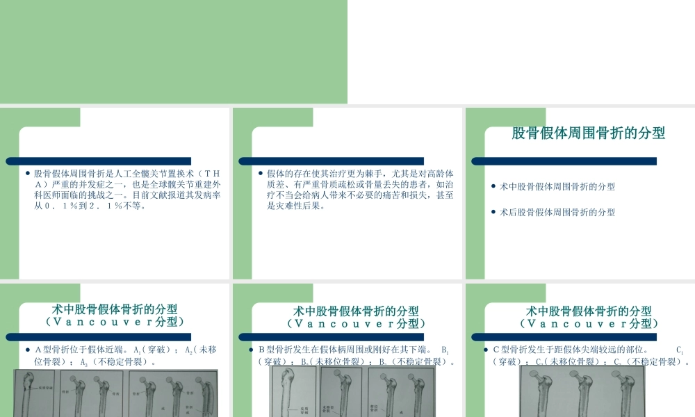 假体周围骨折概况.ppt