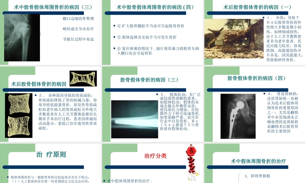 假体周围骨折概况.ppt