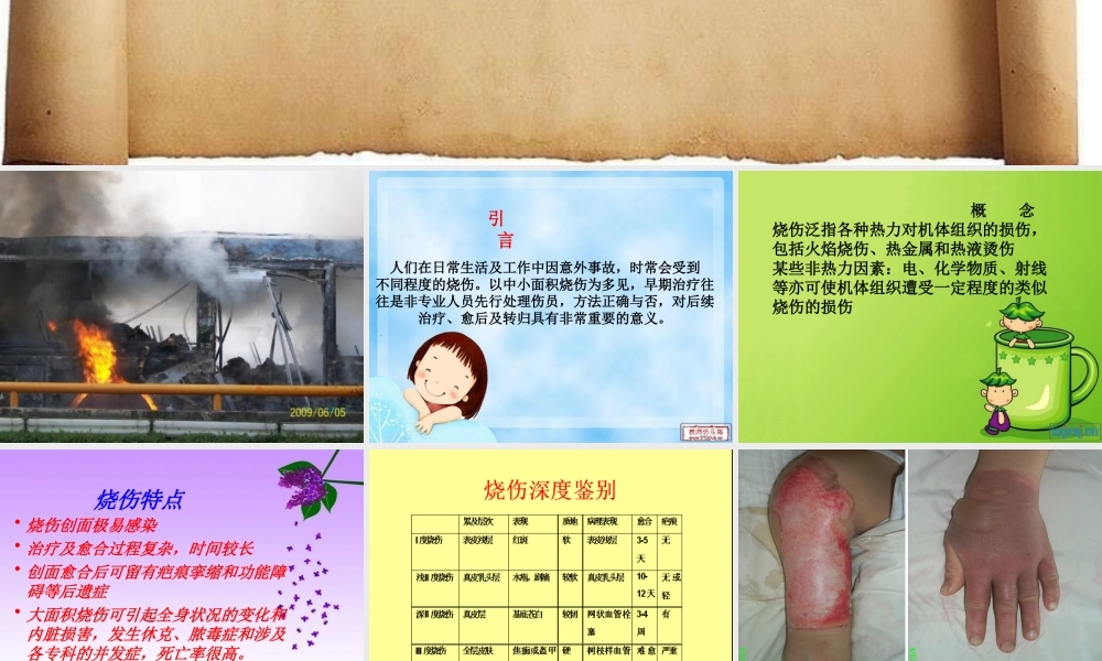 儿童烧伤的健康指导.ppt