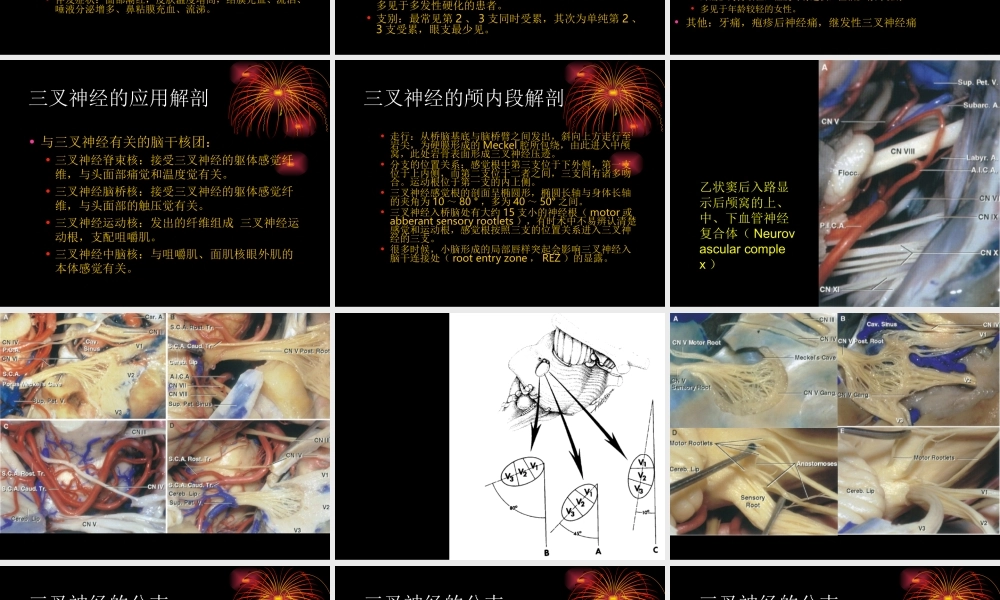 三叉神经痛1.ppt