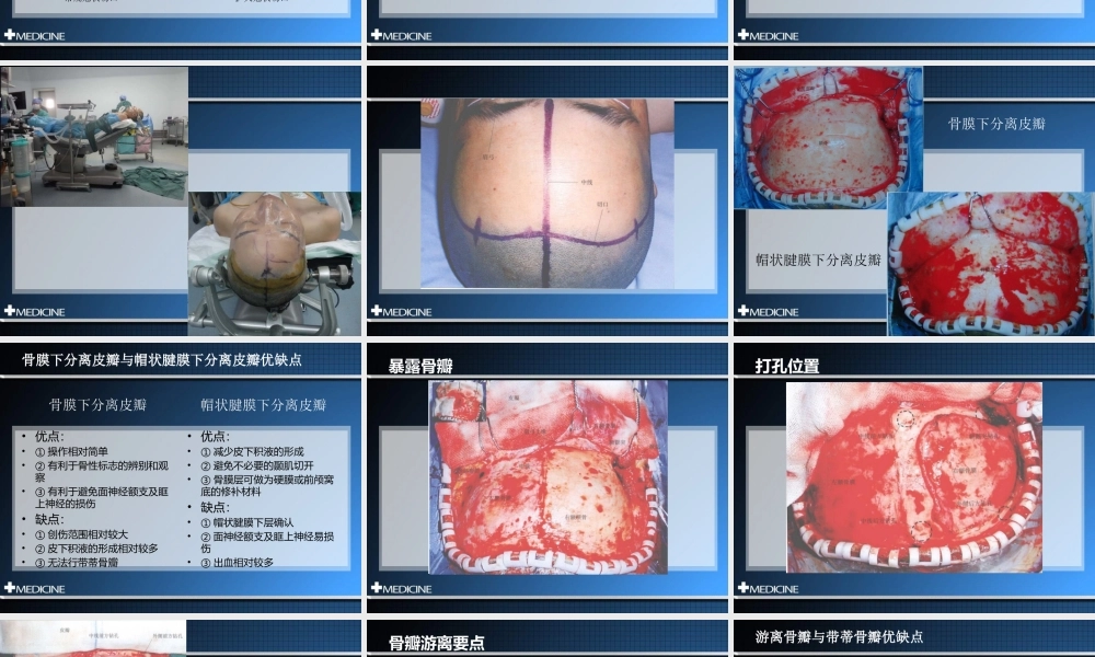 冠切开颅额下入路--福建三博叶忠兴.pptx