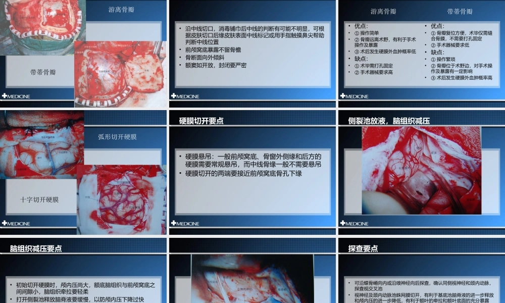 冠切开颅额下入路--福建三博叶忠兴.pptx