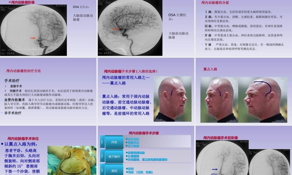 动脉瘤手术配合001+(2).ppt