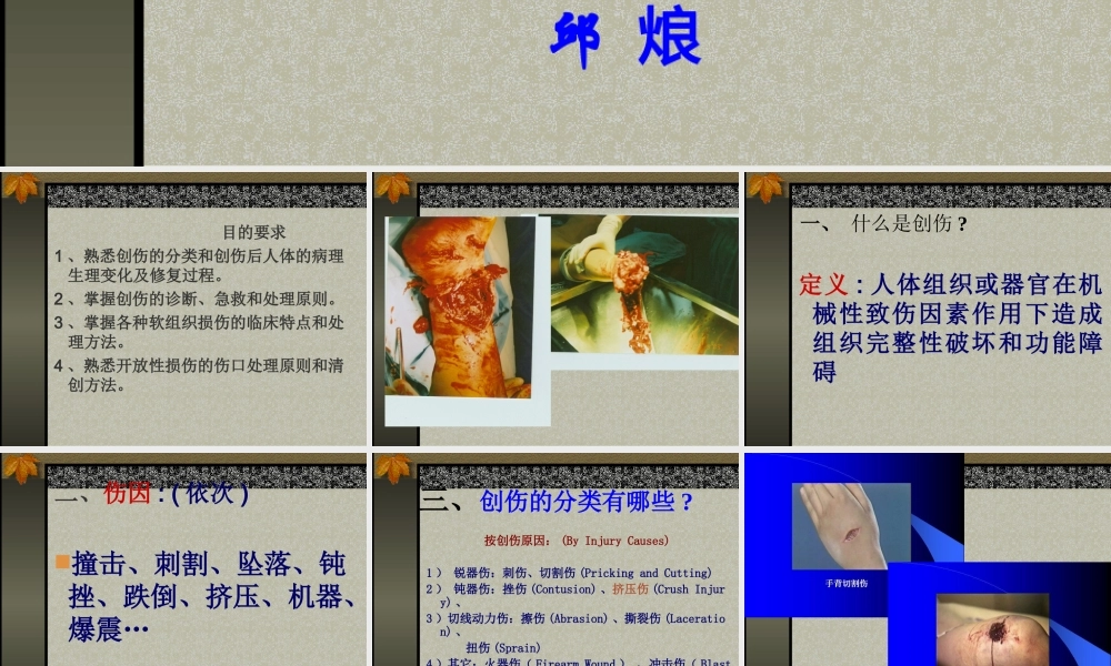 创伤概论.ppt
