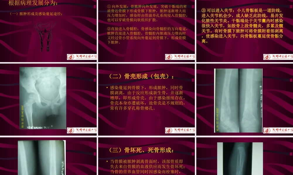 化脓性骨性髓炎-1.ppt