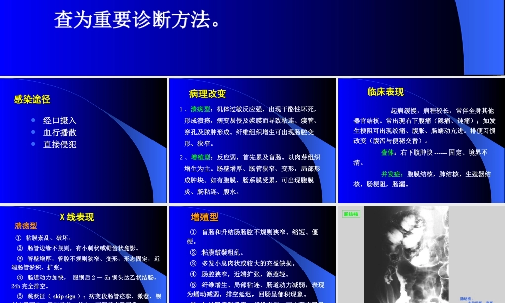 《肠结核》PPT件.ppt