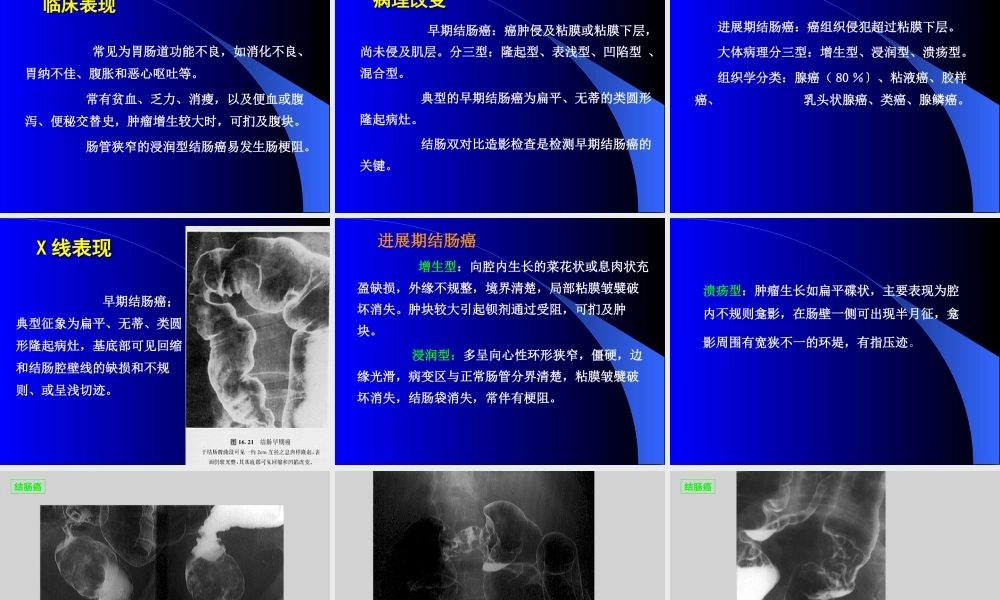 《肠结核》PPT件.ppt