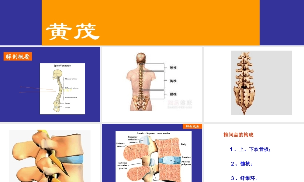 腰椎间盘突出症123(1)介绍.ppt