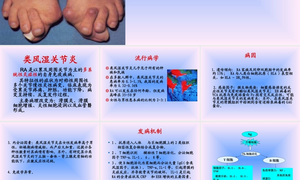 中西结合7年制教材(大量图片)类风湿性关节炎.ppt