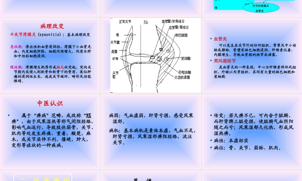 中西结合7年制教材(大量图片)类风湿性关节炎.ppt