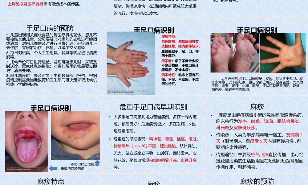 儿童常见传染病.pptx