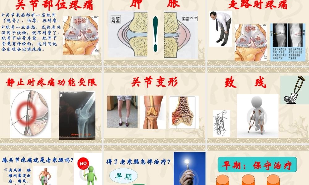 健康知识讲座膝关节.ppt