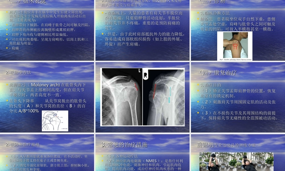 偏瘫患者的常见肩.ppt