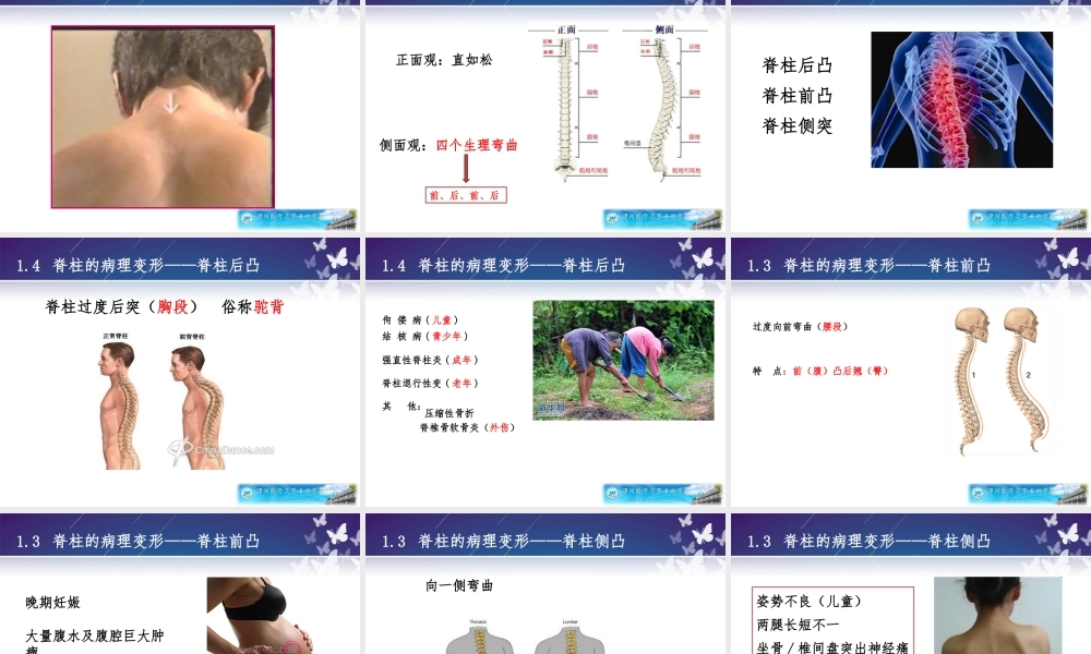 健康评估——脊柱和四肢评估.ppt