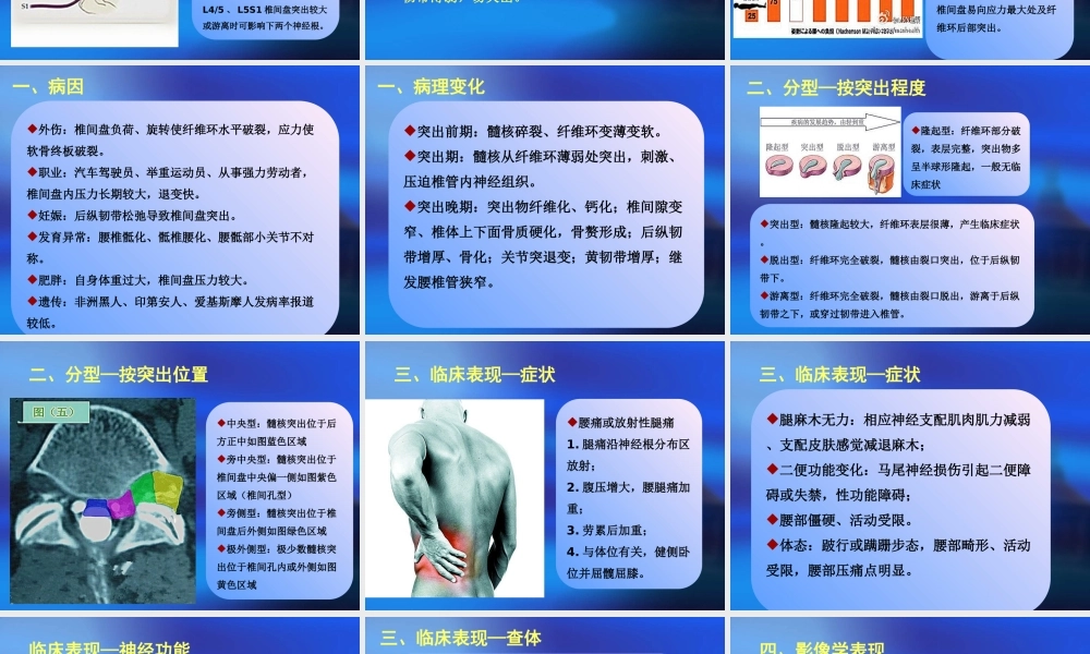 腰椎间盘突出症(zyg).ppt