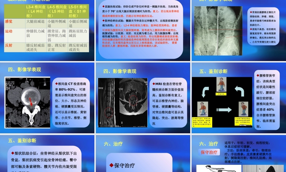 腰椎间盘突出症(zyg).ppt