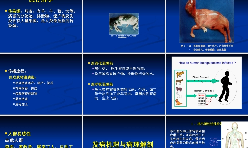布氏肝菌病(人兽共患病).ppt