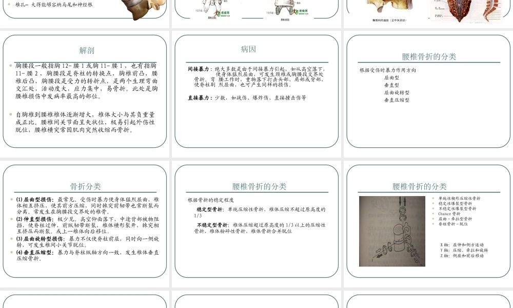 腰椎骨折.ppt