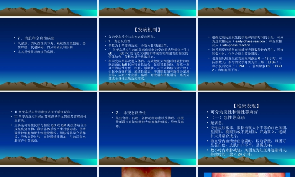 荨麻疹类皮肤病介绍.ppt