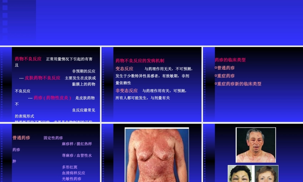 药疹.ppt.ppt